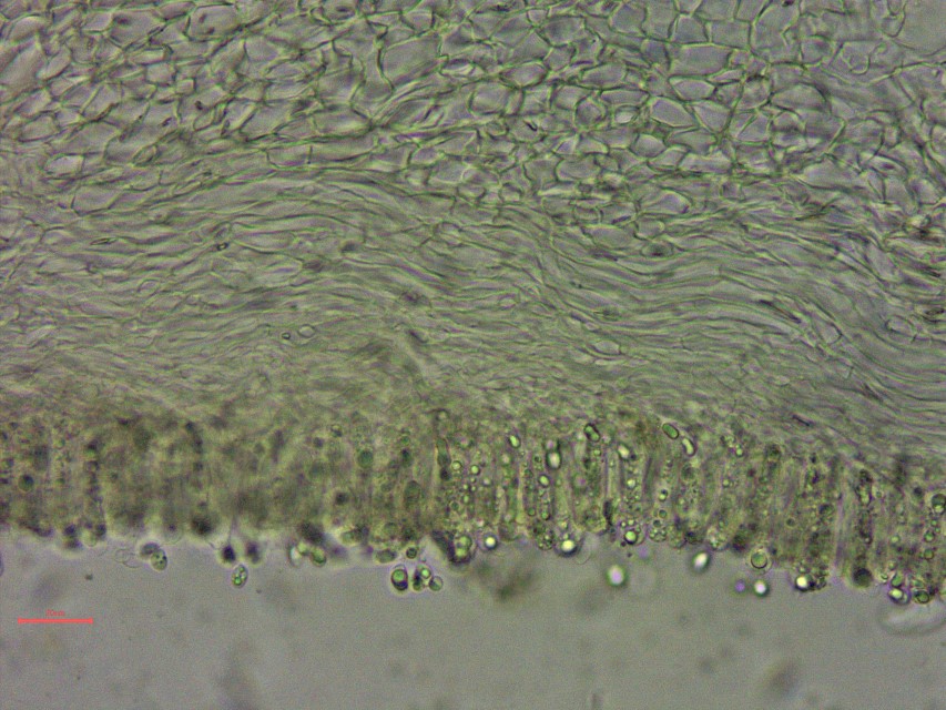 Lyophyllum brunneo ochrascens 18 Ockerbrauner Rasling Lamellen Schnitt Schichtung Hymenium Subhymenium Trama Mikroskopie Krieglsteiner Pilzschule
