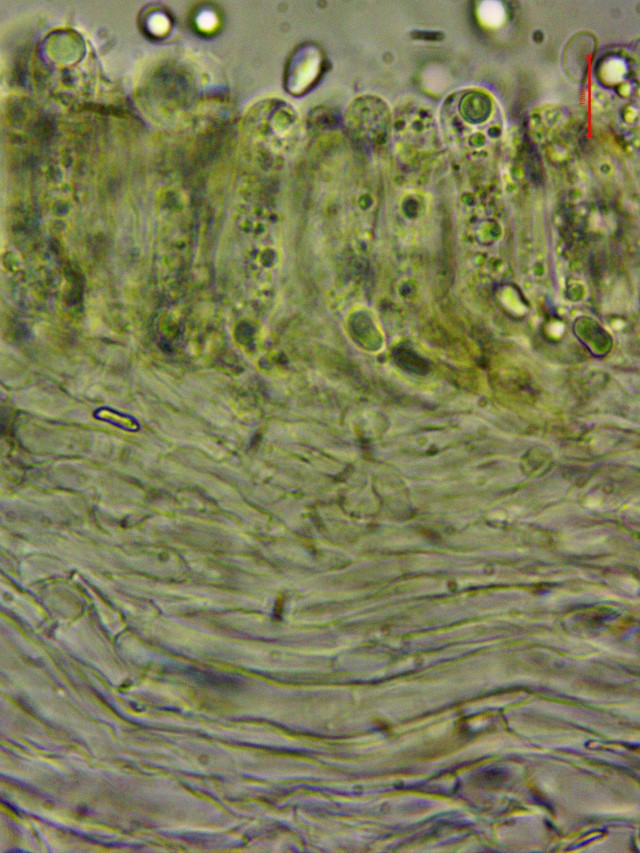 Lyophyllum brunneo ochrascens 19 Hymenium Basidien siderophile Granulation Subhymenium Trama Krieglsteiner Pilzkurse PSV Feldmykologe Pilzforschung