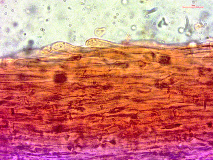 Lyophyllum brunneo ochrascens 20 Ockerbrauner Rasling HDS Hutdeckschicht Cutis Kongorot Zellen radial liegend Mikroskopie Schnitt Katharina Lothar