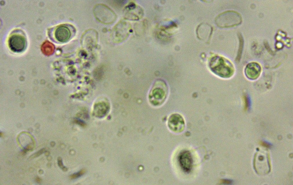 Lyophyllum brunneo ochrascens 9 Sporen KOH tot Oeltropfen Krieglsteiner Mikroskopierkurs Pilzschule Schwaebischer Wald Pilzexpertin Lothar Katharina