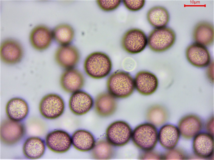 Microbotryum pustulatum 6 Sporenornament Mikroskoperkurs gefaehrdete Pilze Feuchtgruenland nitrophil Duengung Artenvielfalt Biodiversitaet Rueckgang Pestizide