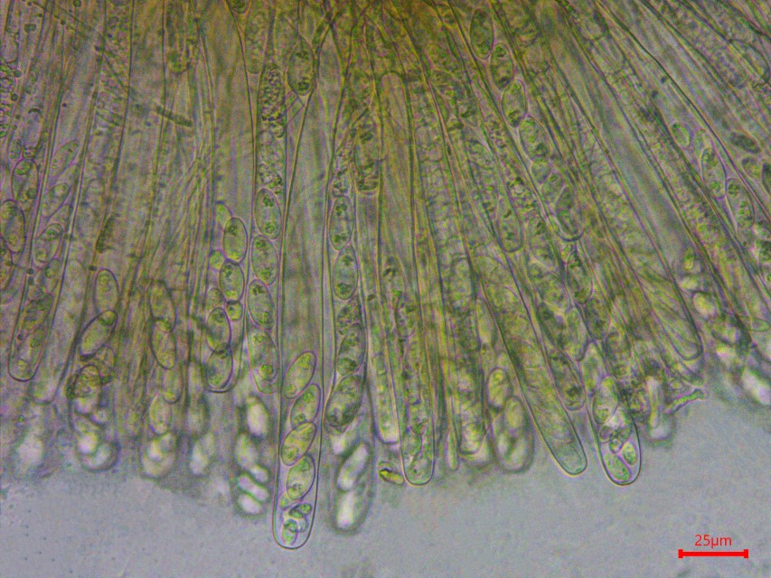 Monilinia baccarum 12 Hymenium Asci Schlauche Paraphysen Sporen Heidelbeer Fruchtbecherchen grosse kleine Pilzexpertin Feldmykologe PSV Pilzschule Krieglsteiner Pilz Custom