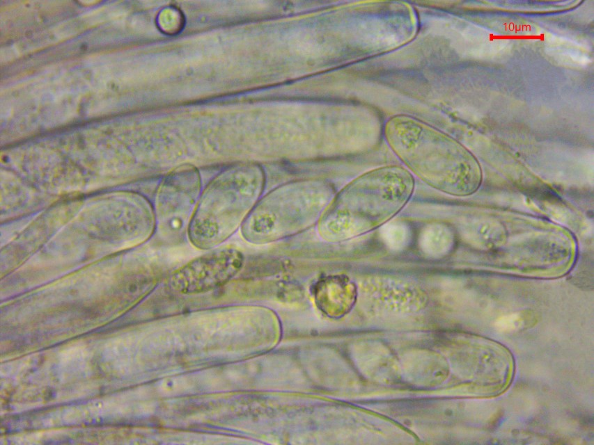 Monilinia baccarum 14 Ascus Spitzen Apex Sporen Oltropfen Guttulen ellipsoidisch abgerundet Baden Wuerttemberg Ostalbkreis Kochertal Waldmannshofen PIlzexpertin Pilz Custom