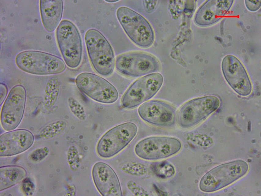 Monilinia baccarum 21 Sporen grosse kleine Mykologe Wasser Praeparat Praparat Immersion Mikroskopie Pilze Ascomyceten Schlauchpilze Becherlinge inoperculate Fruchte Custom