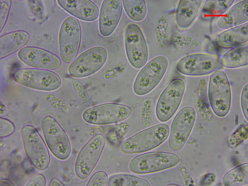 Monilinia baccarum 22 Sporen Wasser lebend tot Vitaltaxonomie Baral in vivo veritas Becherlinge Fruhling vernal discomycete fruit Vaccinium myrtillus Ostalbkreis Custom