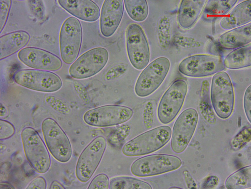 Monilinia baccarum 22 Sporen Wasser lebend tot Vitaltaxonomie Baral in vivo veritas Becherlinge Fruhling vernal discomycete fruit Vaccinium myrtillus Ostalbkreis Custom