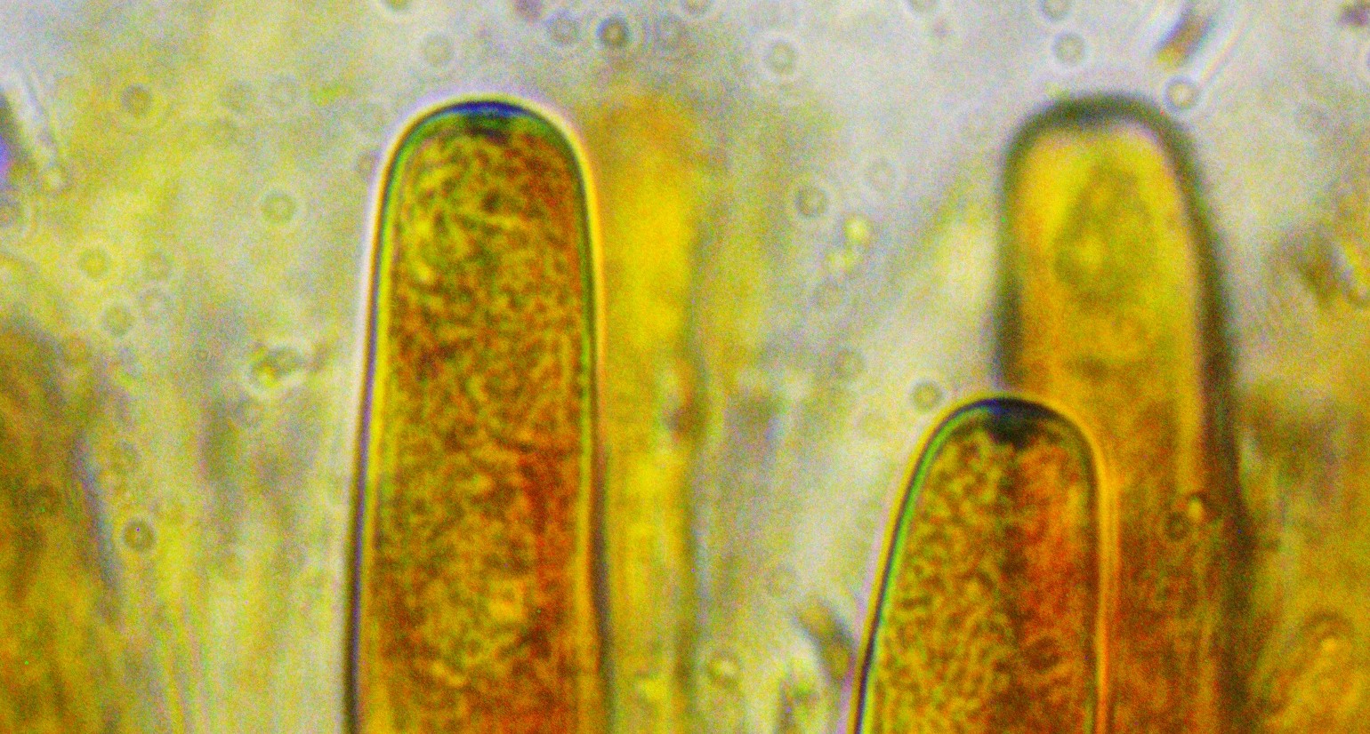 Monilinia baccarum 24 Ascus Apex blau inoperculat Porus Reife Entlassung Sporen entlassen Schlauch keulig Mykologe Torfmoos Sphagnum sauer Stickstoff Duengung Dungung