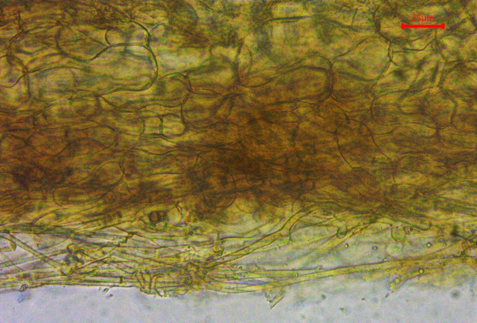 Monilinia baccarum 27 Exzipulum Gehause Gehaeuse haploid dikaryotisch Fruchtschicht Generationengemisch Schlauchpilze Teleomorphe Anamorphe Monilina Obst Faule Mumie Custom