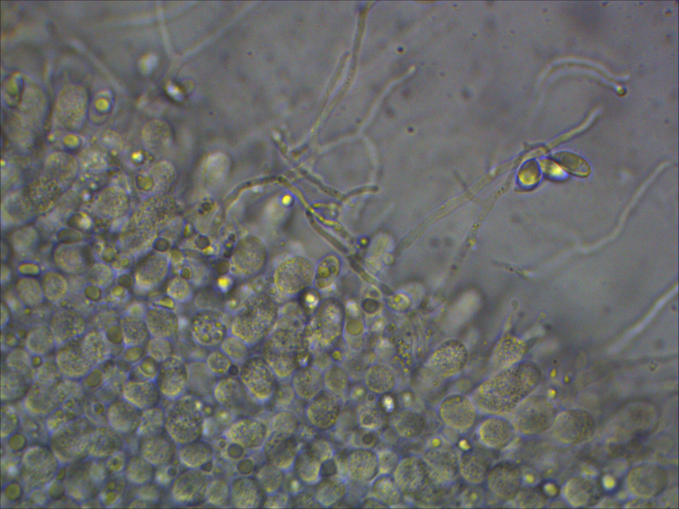 Mycena pasvikensis Cheilozystiden fadenfrmig lang Geruch Gurke Mycena cinerella Lamellen herablaufend Bayern Erstfund Deutschland Krieglsteiner