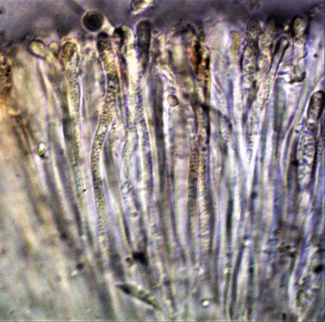Mycobilimbia sphaeroides z Fruchtschicht Paraphysen Guttulen Mikroskopierkurs Flechtenkurs unreife Asci Rote Liste Baden Wuerttemberg vom Aussterben bedroht