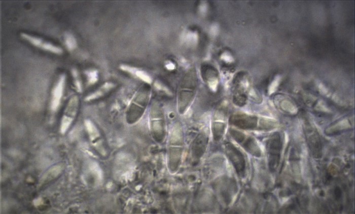 Mycobilimbia sphaeroides z Sporen Fruchtschicht zweizellig KOH Mikroskopierkurs Krieglsteiner Pilzschule Schwaebischer Wald Genozid Esche Kollateralschaden
