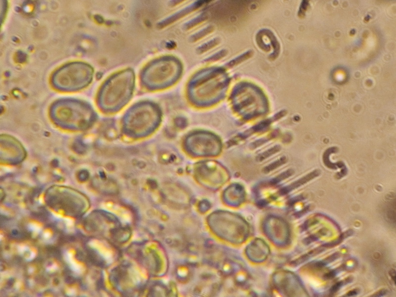 Mycocalia-denudata-Sporen-PIlzschule-Schwaebischer-Wald-Krieglsteiner