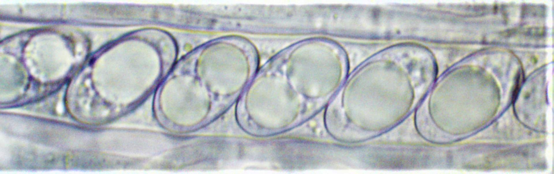 Otidea platyspora Sporen Ascus Oeltropfen Feldmykologe Krieglsteiner Pilzschule Schwaebischer Wald Mikroskopie DNA Eiche Quercus Baden Wuerttemberg Mykorrhizapilz