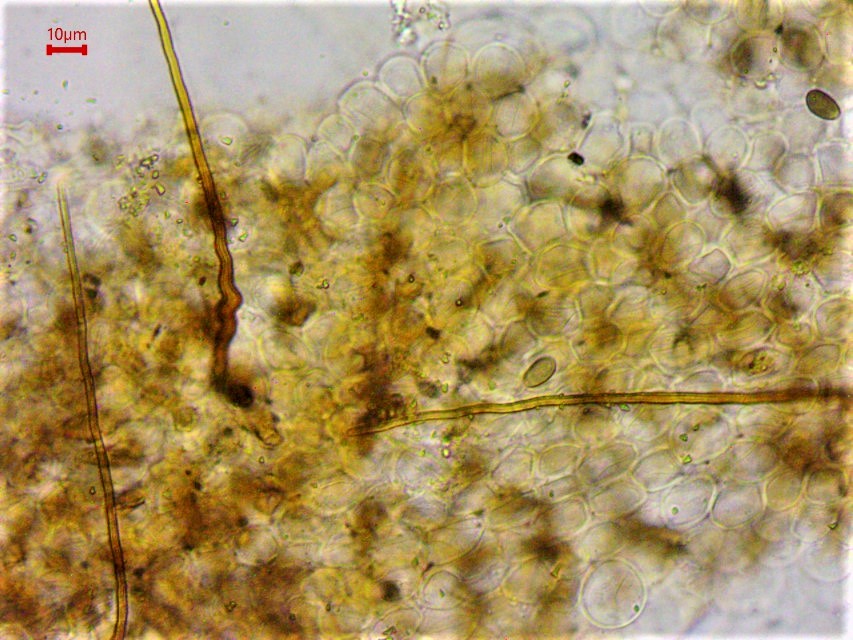 Parasola auricoma 11 Hutdeckschicht Borsten Setae Haare Naturgarten Krieglsteiner Spraitbach Artenvielfalt Biodiversitaet Pilzexperte Pilzschule Liebe Natur Pilze Pilzkurse Pilzexkursionen