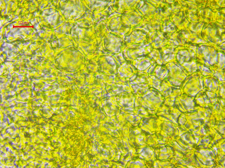 Pezicula acericola 11 Excipulum Exzipulum Gehaeuse textura globulosa Krieglsteiner Schwaebische Alb hemiamyloid Ascomycet Ahorn Rindenbecherchen Alb Pilz Feldmykologe Mykologie