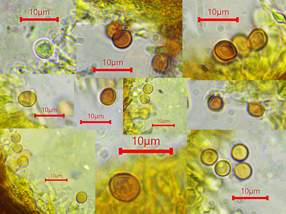 Phellinus erectus 5 Fomitiporia Sporen hyalin dextrinoid rund ellipsoidisch dickwandig Melzers Reagens Krieglsteiner Portugal Algarve Barrocal