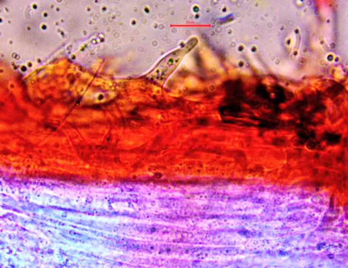 Physalacria cryptomeriae 11 Stielzystide Mikroskopierkurs Pilzschule Schwaebischer Wald Krieglsteiner Erstnachweis Baden Wuerttemberg Rems Murr Kreis winzig