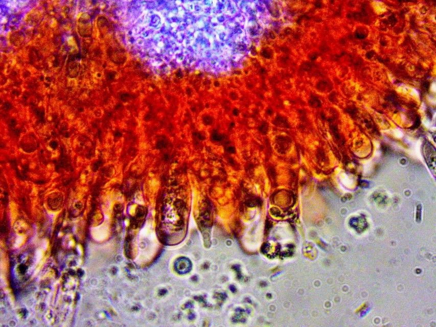 Physalacria cryptomeriae 9 Basidie oelreich Hymenialzystide Krieglsteiner Kongorot Pilzschule Ruppertshofen Schwaebisch Gmuend Baden Wuerttemberg