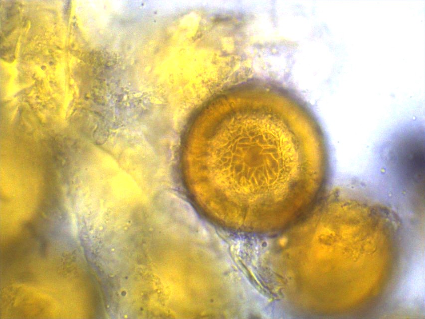 Physoderma potteri 12 parasitische Pilze Pflanzengallen Cecidien Krieglsteiner Nationalpark Eifel Erstnachweis Deutschland Torfmoos