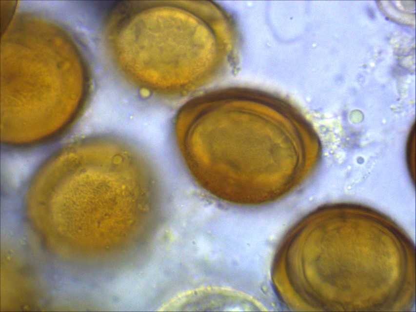 Physoderma potteri 8 terrestrisch aquatisch parasitische Pilze Chytridiomycota Zygomycota Jochpilze Flagellatenpilze Toepfchen Pilzkurs