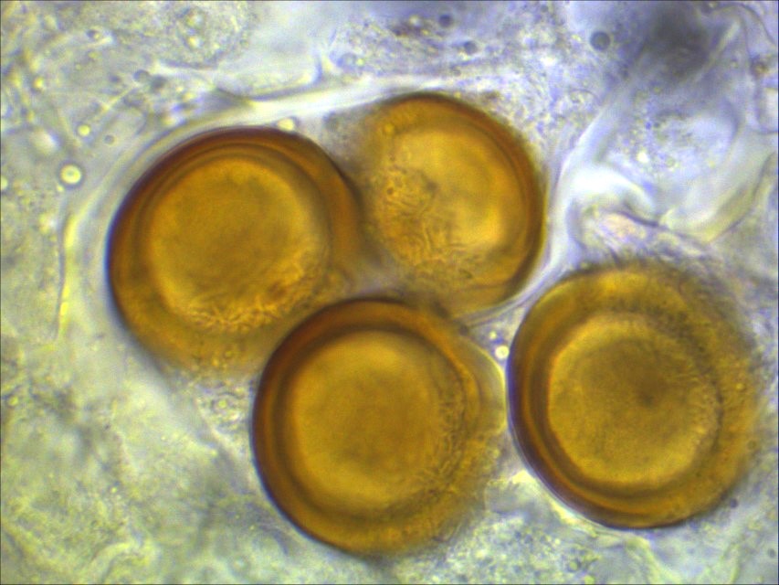 Physoderma potteri 9 Nationalpark Eifel Erstbeschreibung England Dauersporen Pflanzengalle rund Mikroskopierkurs Krieglsteiner Pilzkurs