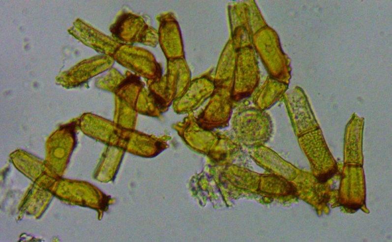 Puccinia coronata Kronenrost Teliosporen zweizellig gekroent Corona Virus Pandemie Baden Wuerttemberg Pilze lernen Feldmykologe Krieglsteiner Medium