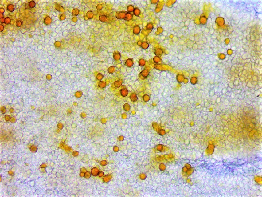 Rhodocybe ardosiaca 2 Clitopilus Violettspitziger Raesling Tellerliung Chrysozystiden Pseudozystiden Lamellenschneide flche KOH gelb Zuericher See Schweiz Krieglsteiner