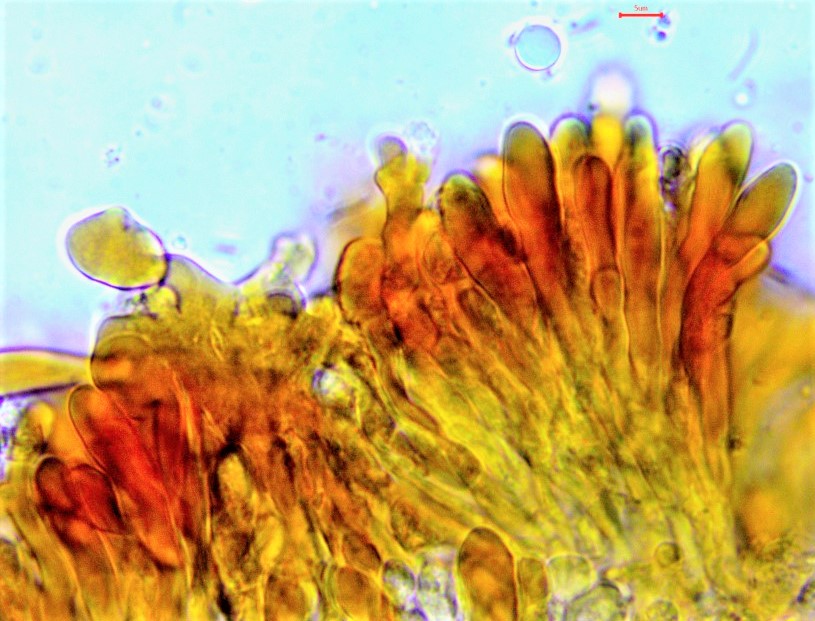 Rhodocybe ardosiaca 5 Chryso Cheilozysttiden KOH Krieglsteiner Pilzschule Schwaebischer Wald Violettstieliger Tellerling Mehlgeruch Lamellen herablaufend Pilzkurs Schweiz