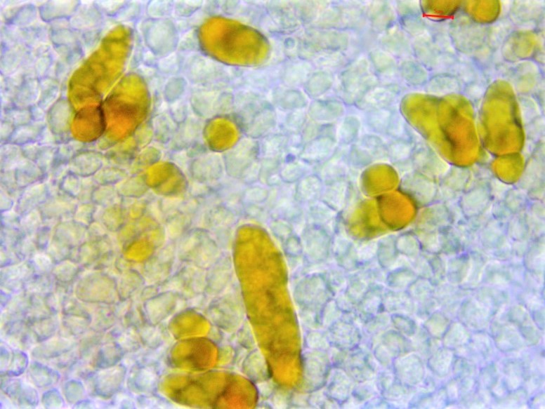 Rhodocybe ardosiaca 7 Violettspitziger Tellerling Pleuro Chrysozystiden Pseudozystiden Mikroskopierkurs Feldmykologe Krieglsteiner Pilzschule Schwaebischer Wald Schweiz