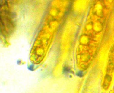 Trochila-tini-Asci-euamyloid-Lugol-IKI-blau-Calycina-Typ-Schläuche-Jod-Stuttgart-Pilzschule-Pilzkurse-Pilzseminare-Becherlinge-Schlauchpilze-Mittelmeer-Portugal-Alentejo-cogumelo-Paraphysen-Vakuolenkörper-Fruchtschicht-sterile-Zellen-Becherlinge-Pigment-Spezialkurse-Pilzschule-Schwäbischer-Wald-Schlauchpilze-Spezialkurse-Hessen-Bayern-Baden-Württemberg-Schwäbisch-Gmünd-Niedersachsen