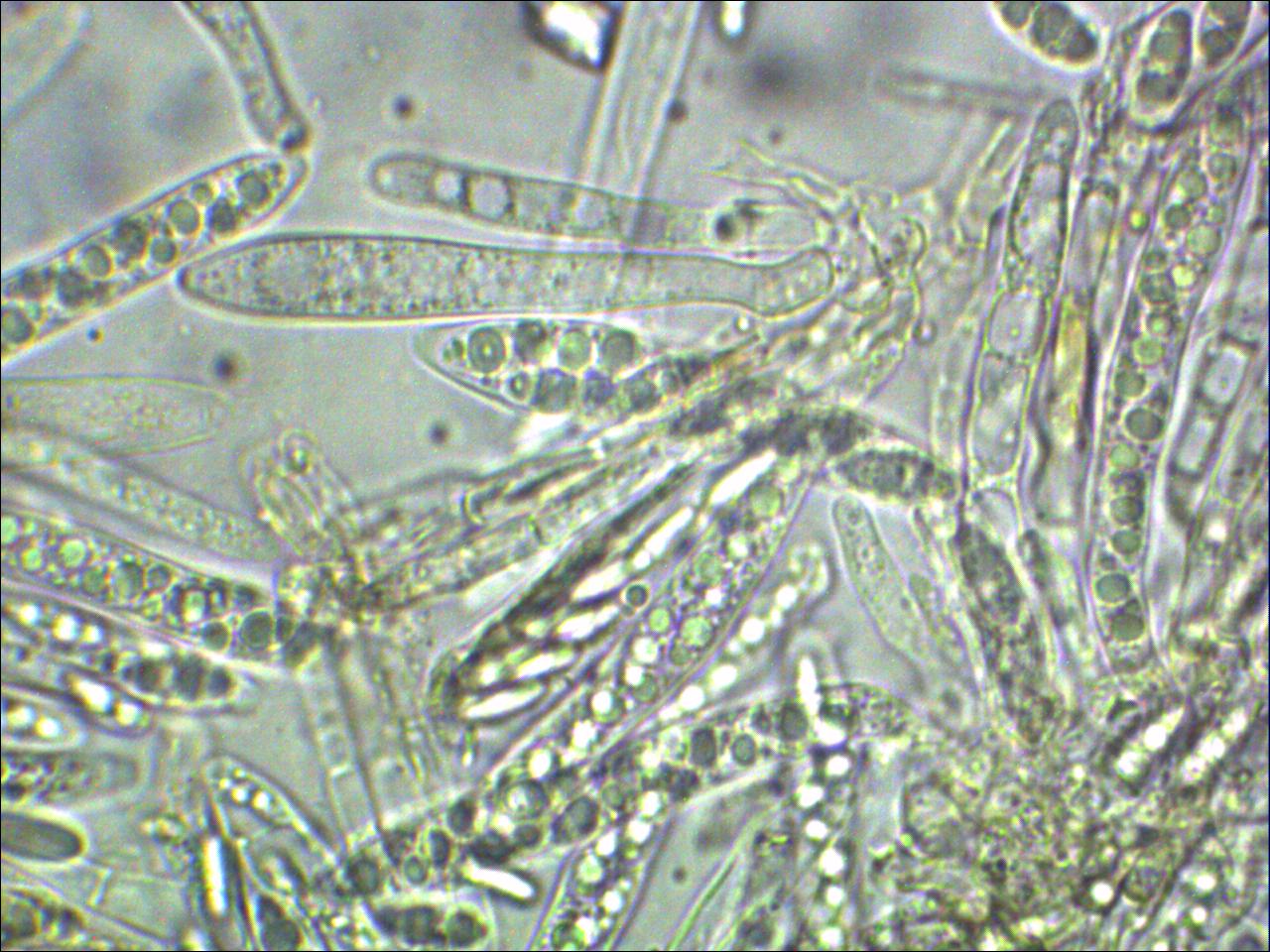 Trochila-tini-Asci-Sporen-Schneeball-Becherling-Stuttgart-Pilzkurse-Pilzschule-Schwäbischer-Wald-Pilzseminare-Paraphysen-Margo-Schläuche-Asci-Sporen-lebend-Vitaltaxonomie