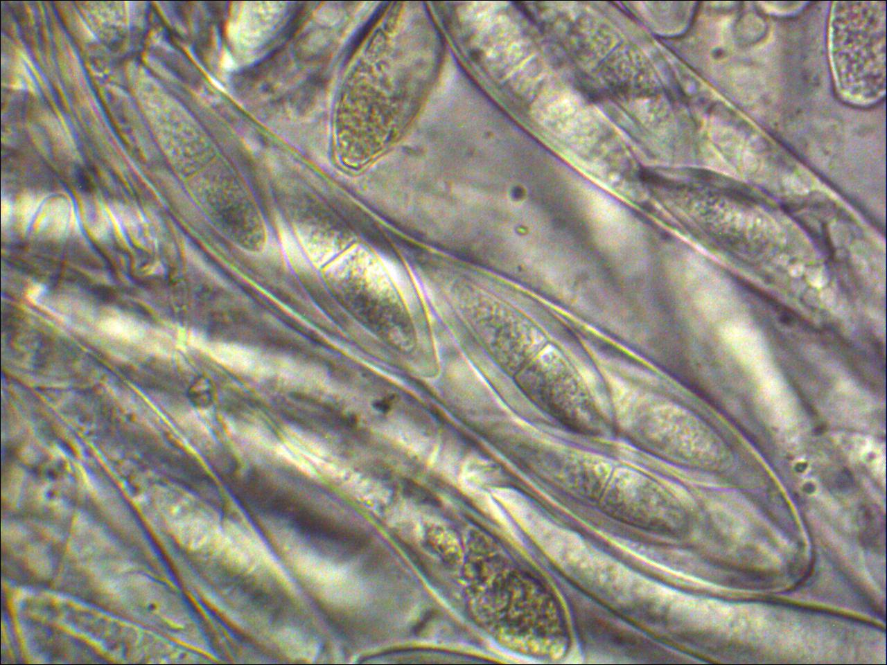 Tryblidiopsis-pinastri-Sporen-Österreich-Tirol-Lechtaler-Alpen-Fichte-Picea-abies