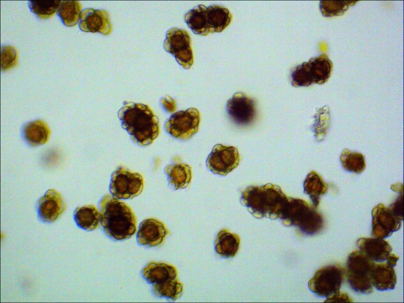 Urocystis colchici Sporenballen Mikroskop Frankfurt Moenchbruch Herbstzeitlose 800x600