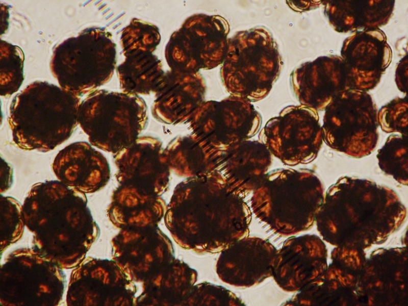 Urocystis syncocca Sporenballen Rhoen Bayern Mikroskop Parasit Leberbluemchen Hepatica 800x600