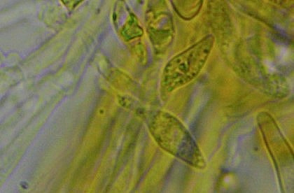 Woldmaria filicina Mikroskopie 2 Sporen lebend multiguttulat crocea Ostalbkreis Schwaebisch Gmuend Krieglsteiner Garten