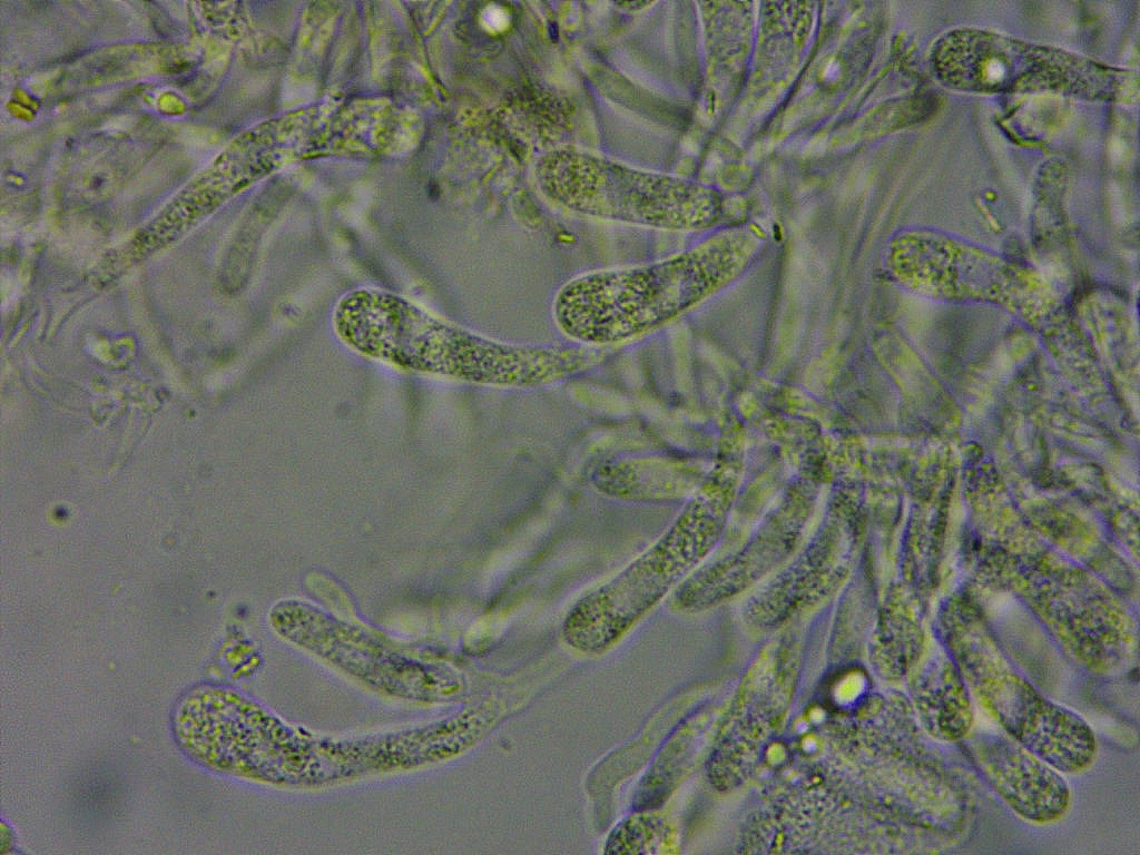 Woldmaria filicina Mikroskopie 3 Staender Basidien unreif lebendig multiguttulat Straufarn Matteucia Ostalbkreis Pilzkurs Seminar