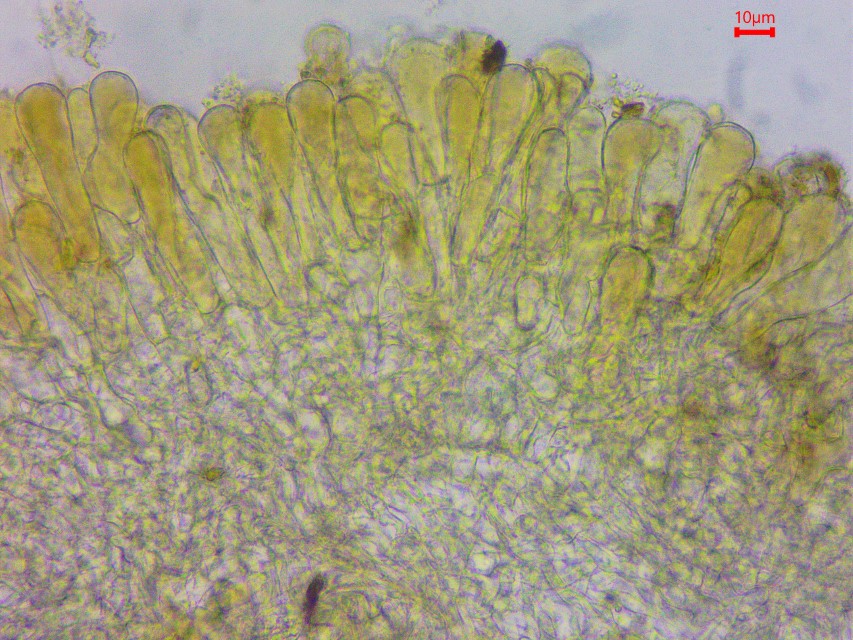 Wynnella silvicola 10 Schnitt Excipulumtextura prismatica Endzellen Palisaden braun pigmentiert keulig abgerundet Mikroskopierkurs Pilzschule Schwaebischer Wald