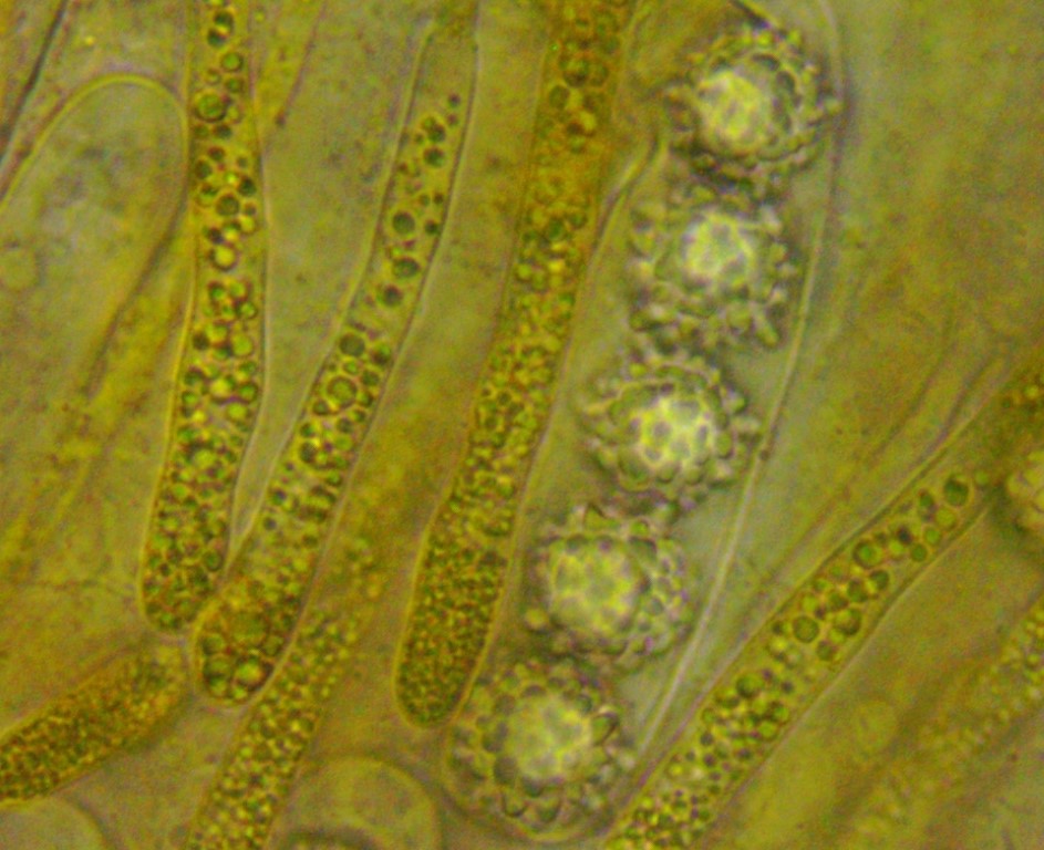 z Lamprospora esterlechnerae Dicranodontium Isny Umg. Tobel 4 18.23.10. Medium