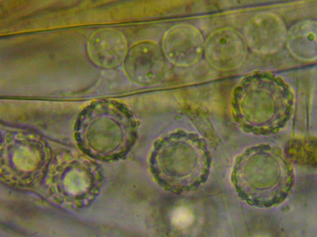 z Lamprospora esterlechnerae Dicranodontium Isny Umg. Tobel 8 18.23.10. Medium