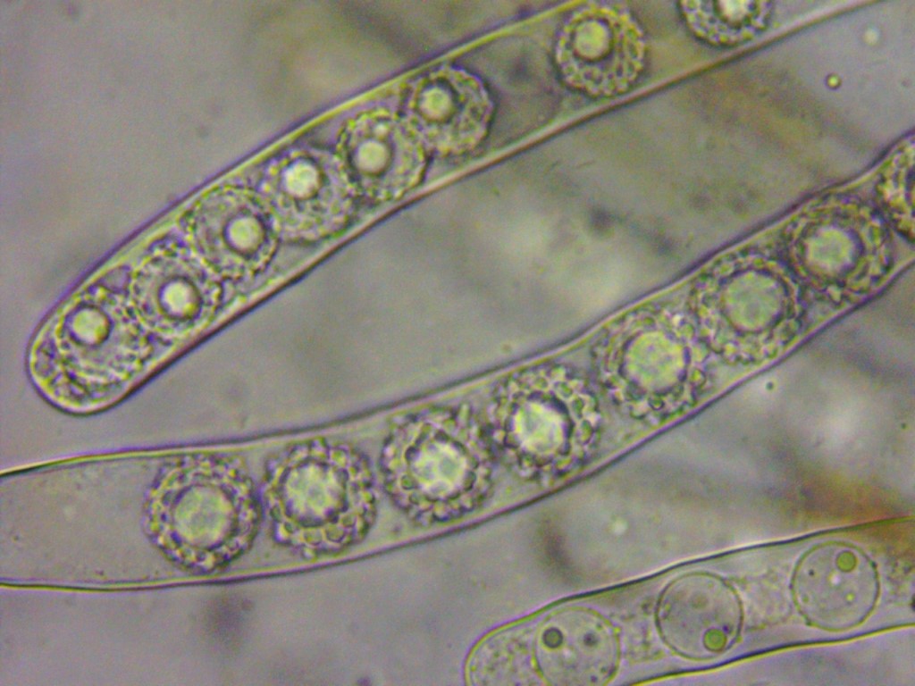 z Lamprospora esterlechnerae Dicranodontium Isny Umg. Tobel 9 18.23.10. Medium